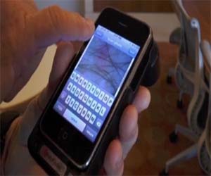 مصر اليوم - تطبيق جديد لآيفون يكشف سرطان الجلد